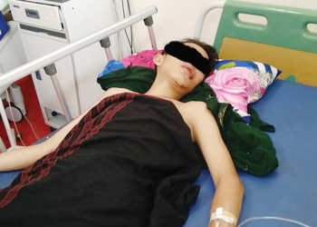 Dua Remaja Jadi Korban Tabrak Lari, Seorang di Antaranya Tak Sadarkan Diri hingga 14 Jam