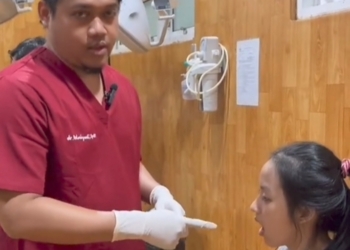 Viral Nguap Terlalu Lebar, Gadis Cantik 18 Tahun Tak Bisa Tutup Mulut, Begini yang Dilakukannya