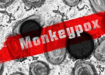 2 Pasien Cacar Monyet Cirebon