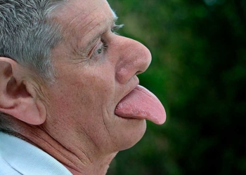 Penjelasan Ilmiah Julurkan Lidah Bisa Cegah Alzheimer atau Kepikunan