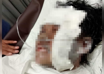 Suami di Cirebon Tega Bakar Istri Hidup-hidup