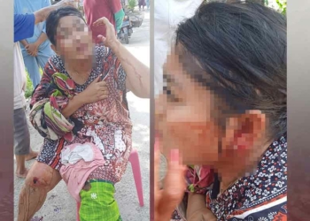 Menolak Ajakan Rujuk, Mantan Istri di Cirebon Ditusuk Mantan Suami Sambil Teriak “Kamu Harus Mati”
