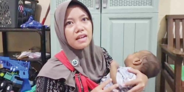 Usia Delapan Bulan Sudah Dua Kali Operasi, Anak Penderita Penyakit Langka di Cirebon Butuh Perhatian Pemda