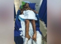 Kebakaran Di Cirebon, Nenek 70 Tahun Sakit Stroke Alami Luka