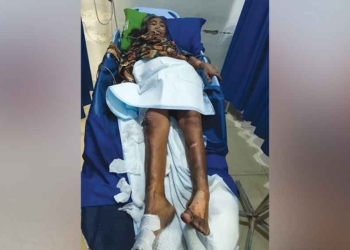 Kebakaran Di Cirebon, Nenek 70 Tahun Sakit Stroke Alami Luka
