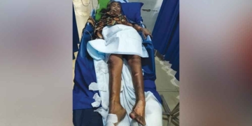 Kebakaran di Cirebon, Nenek 70 Tahun Sakit Stroke Alami Luka 7 Kebakaran Di Cirebon, Nenek 70 Tahun Sakit Stroke Alami Luka