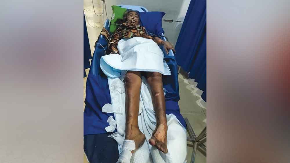 Kebakaran di Cirebon, Nenek 70 Tahun Sakit Stroke Alami Luka 1 Kebakaran Di Cirebon, Nenek 70 Tahun Sakit Stroke Alami Luka