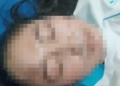 Perawat di Kabupaten Cirebon Diduga Dianiaya Dokter, Polisi Lakukan Penyidikan 2 Perawat Di Kabupaten Cirebon Diduga Dianiaya Dokter, Polisi Lakukan Penyidikan