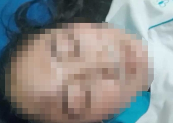 Perawat di Kabupaten Cirebon Diduga Dianiaya Dokter, Polisi Lakukan Penyidikan 1 Perawat Di Kabupaten Cirebon Diduga Dianiaya Dokter, Polisi Lakukan Penyidikan