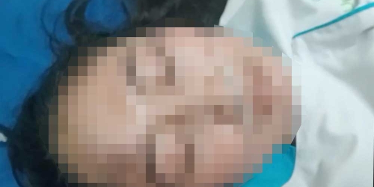 Perawat di Kabupaten Cirebon Diduga Dianiaya Dokter, Polisi Lakukan Penyidikan 6 Perawat Di Kabupaten Cirebon Diduga Dianiaya Dokter, Polisi Lakukan Penyidikan