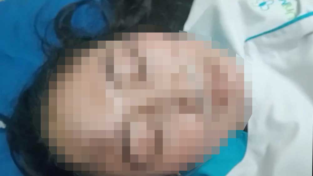 Perawat di Kabupaten Cirebon Diduga Dianiaya Dokter, Polisi Lakukan Penyidikan 1 Perawat Di Kabupaten Cirebon Diduga Dianiaya Dokter, Polisi Lakukan Penyidikan